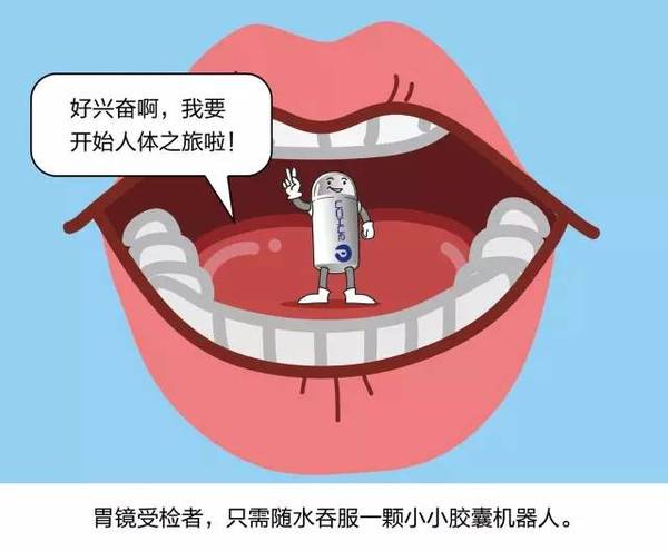 最新胃镜检查不插管多少钱