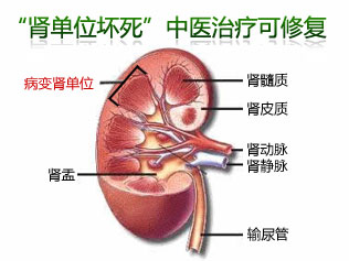 尿毒症最新消息