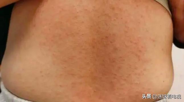 深圳止咳水最新新闻